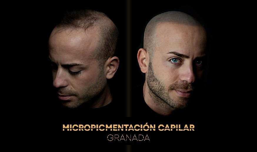 Micropigmentacion capilar granada fondo web logo